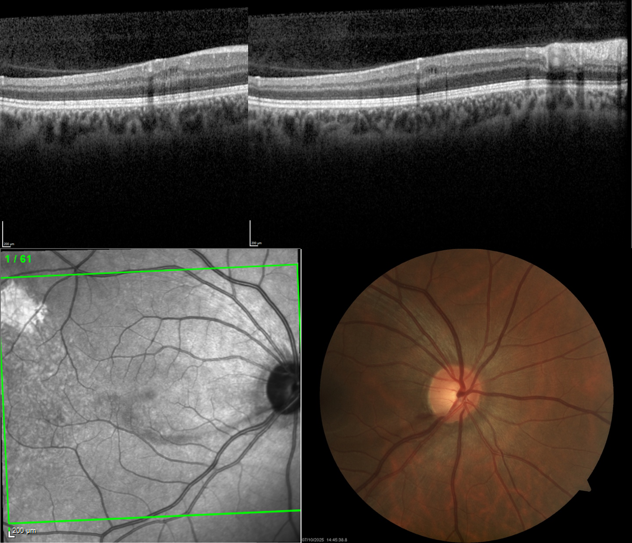 Example Image